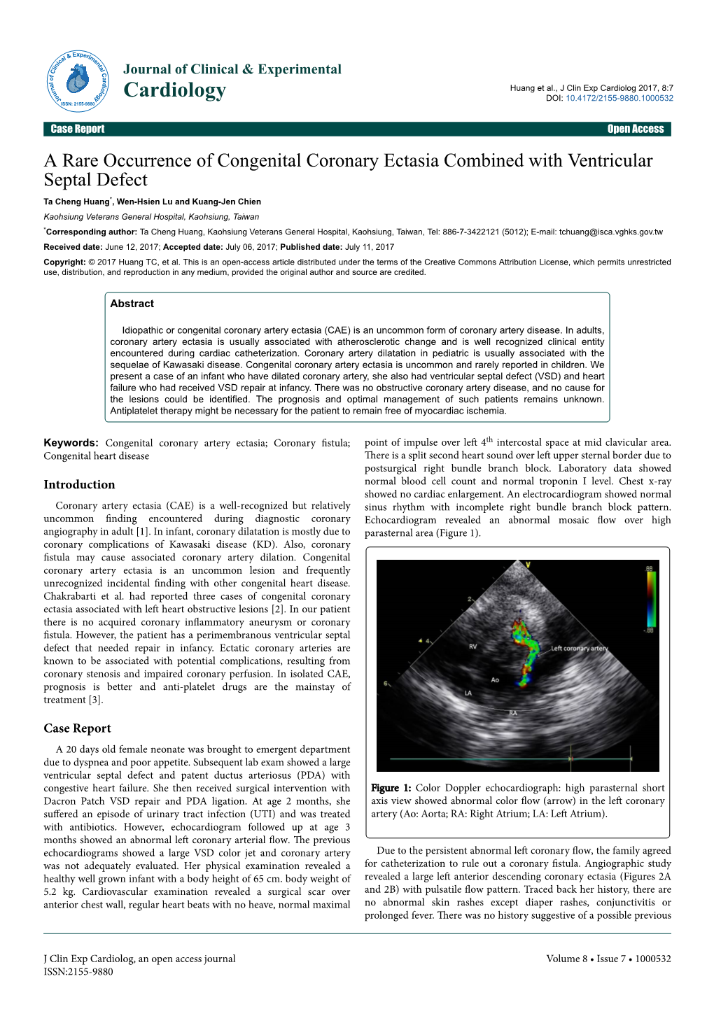 A Rare Occurrence of Congenital Coronary Ectasia Combined With