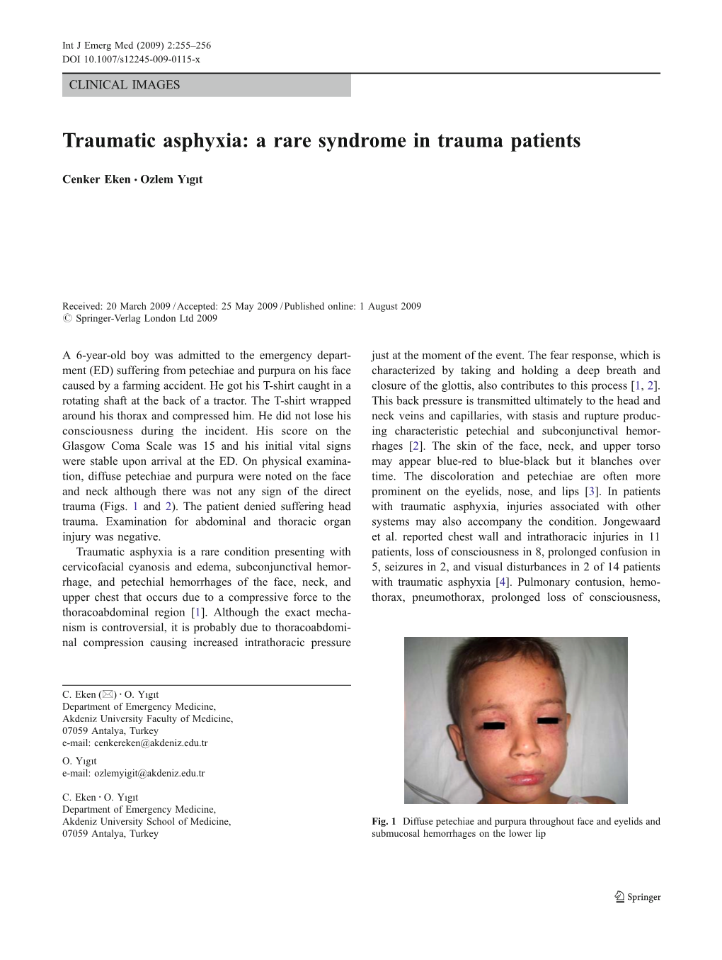 Traumatic Asphyxia: a Rare Syndrome in Trauma Patients