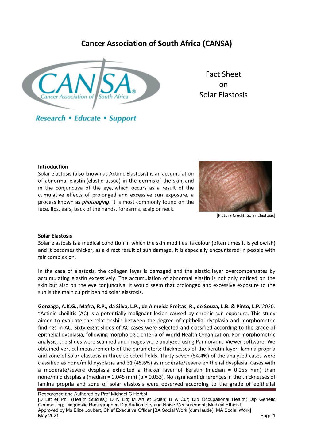 Fact Sheet on Solar Elastosis