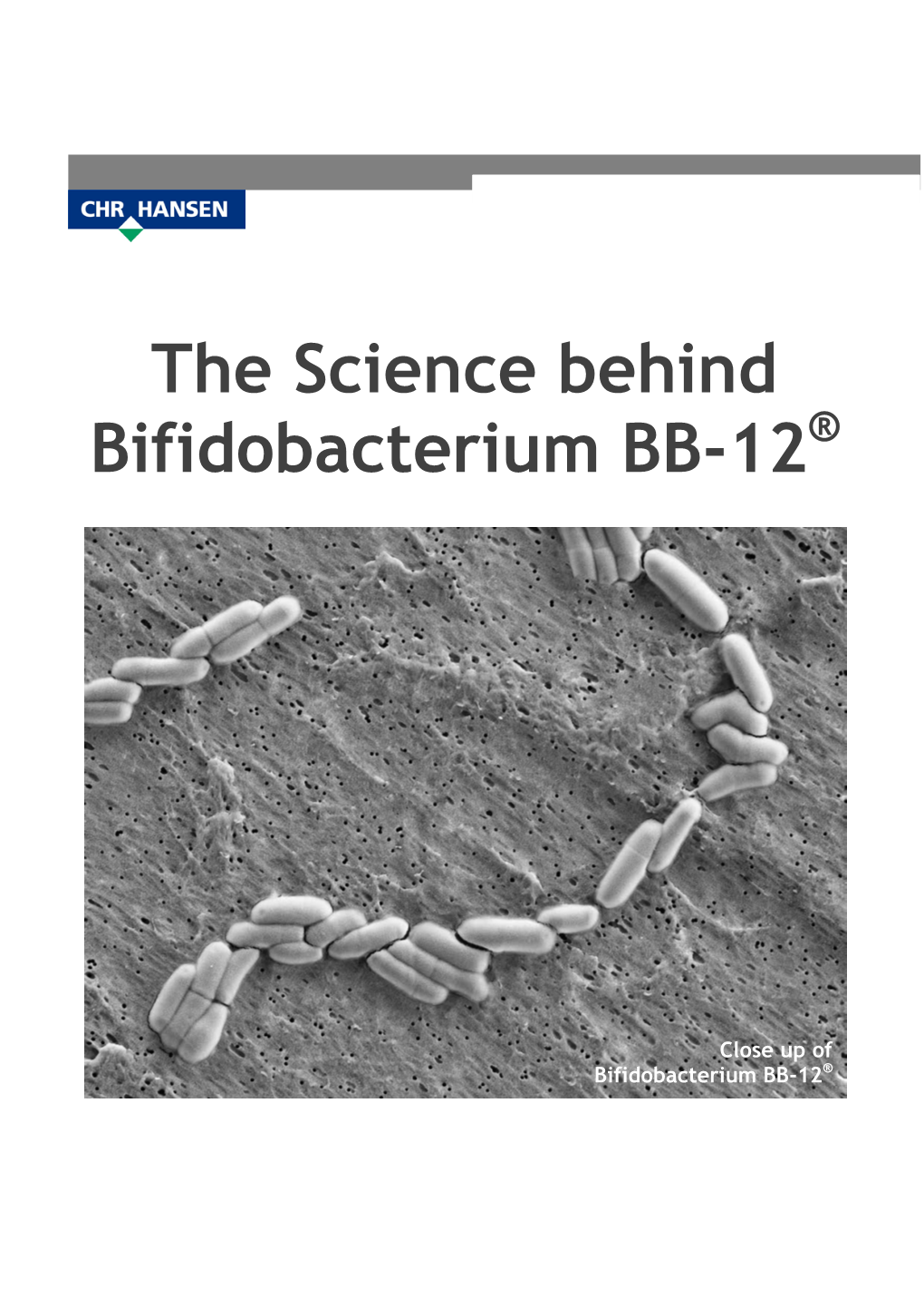 The Science Behind Bifidobacterium BB-12®