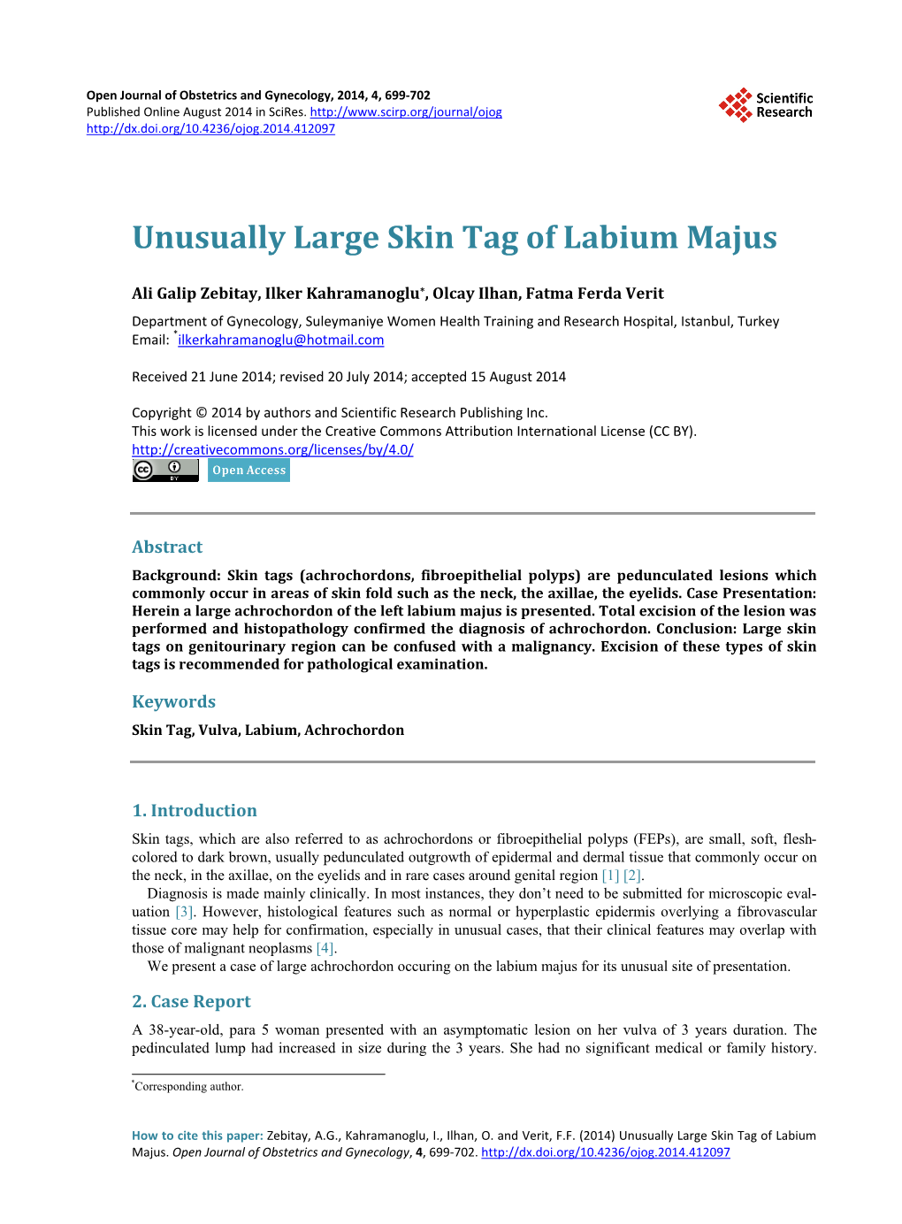 Unusually Large Skin Tag of Labium Majus