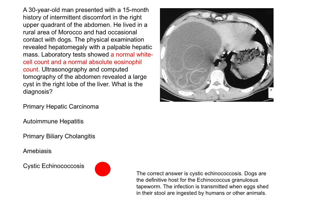 A 30-Year-Old Man Presented with a 15-Month History of Intermittent Discomfort in the Right Upper Quadrant of the Abdomen