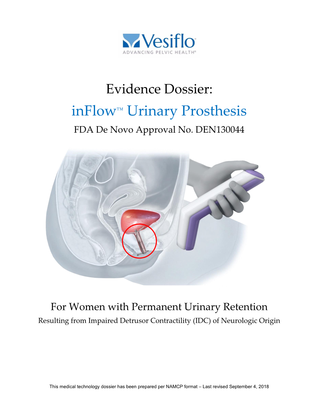 Inflow™ Urinary Prosthesis FDA De Novo Approval No