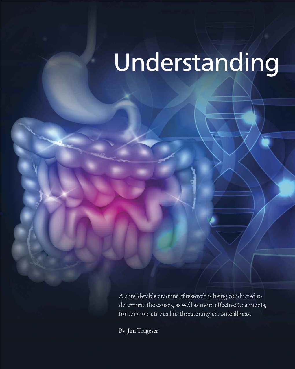 Understanding Crohn's Disease