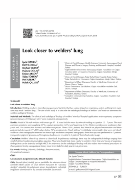Look Closer to Welders' Lung