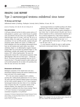 Type 2 Sacrococcygeal Teratoma Endodermal Sinus Tumor