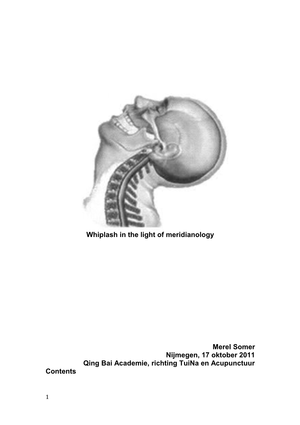 Whiplash in the Light of Meridianology