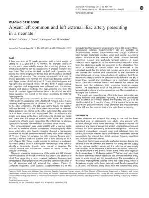 Absent Left Common and Left External Iliac Artery Presenting in a Neonate
