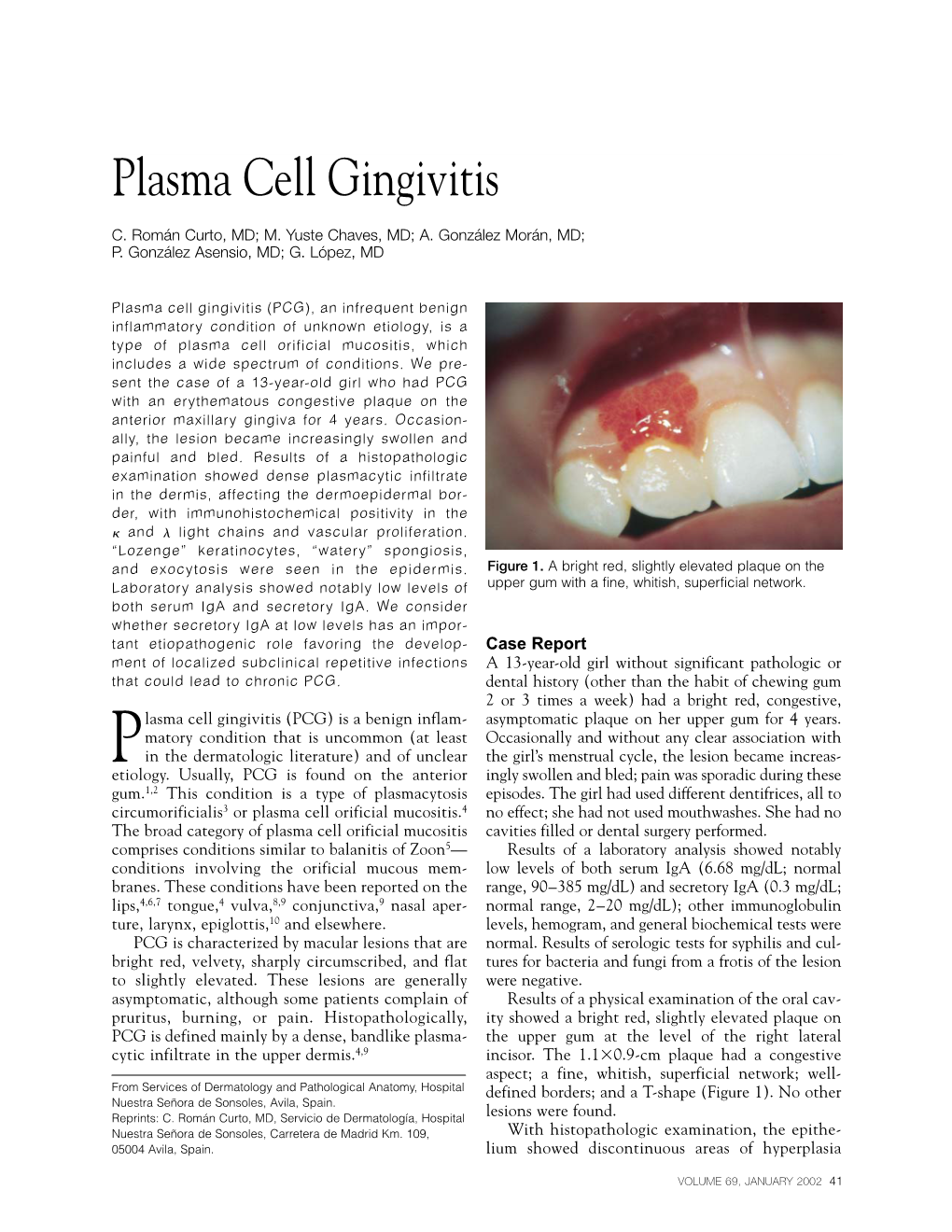 Plasma Cell Gingivitis