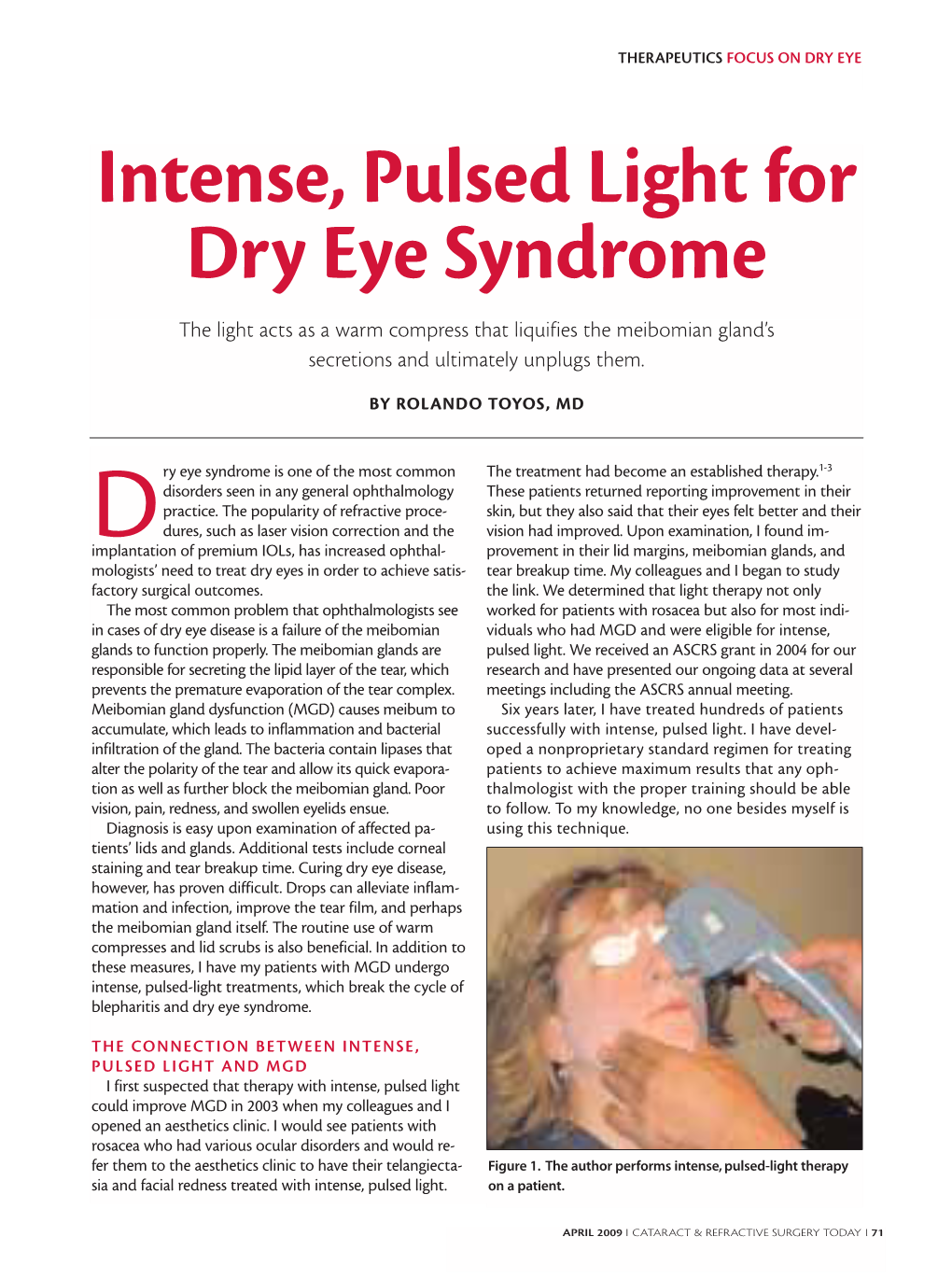 Intense, Pulsed Light for Dry Eye Syndrome