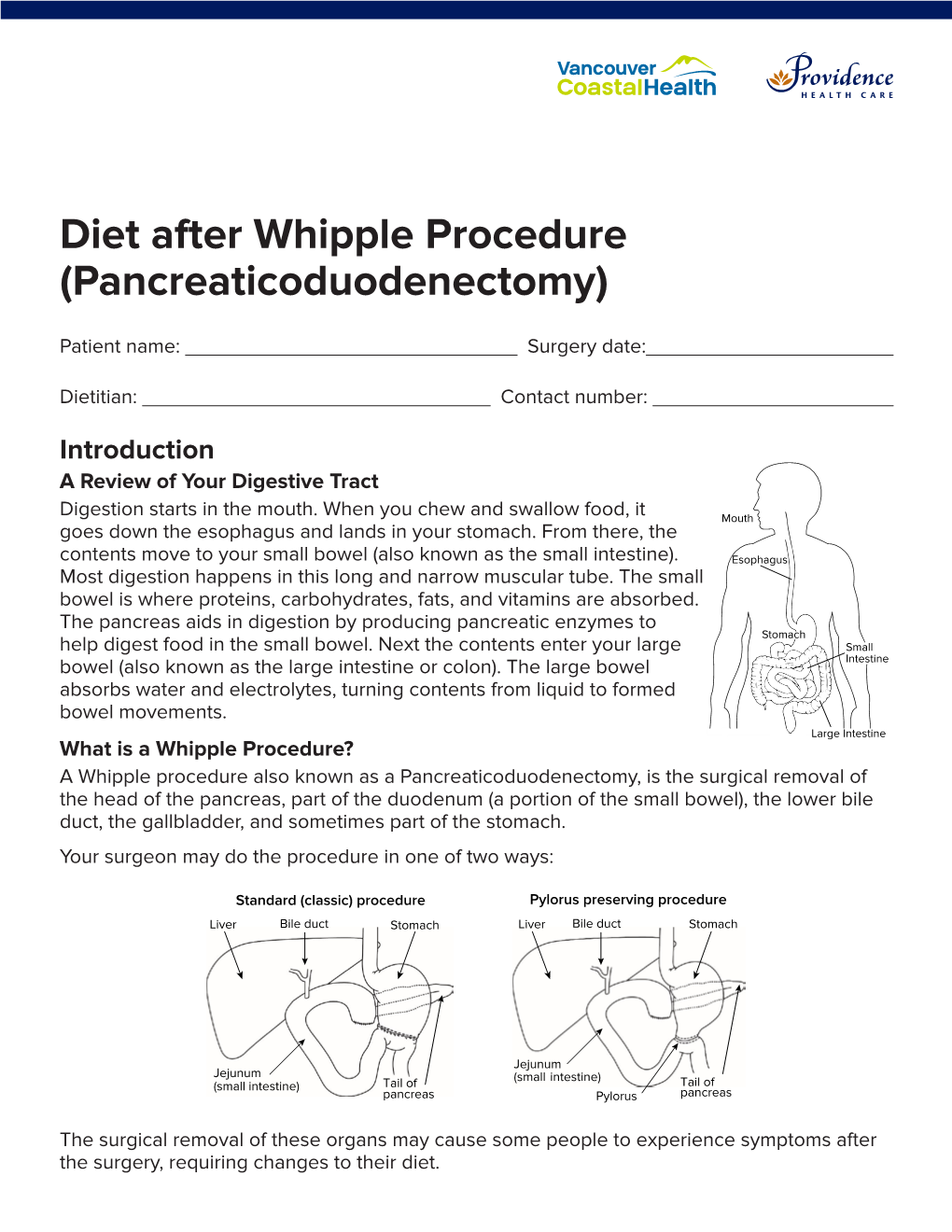 Diet After Whipple Procedure (Pancreaticoduodenectomy)