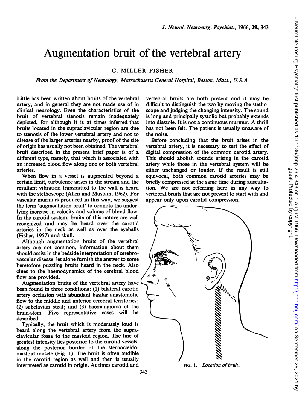 Augmentation Bruit of the Vertebral Artery