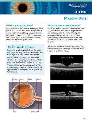 Macular Hole