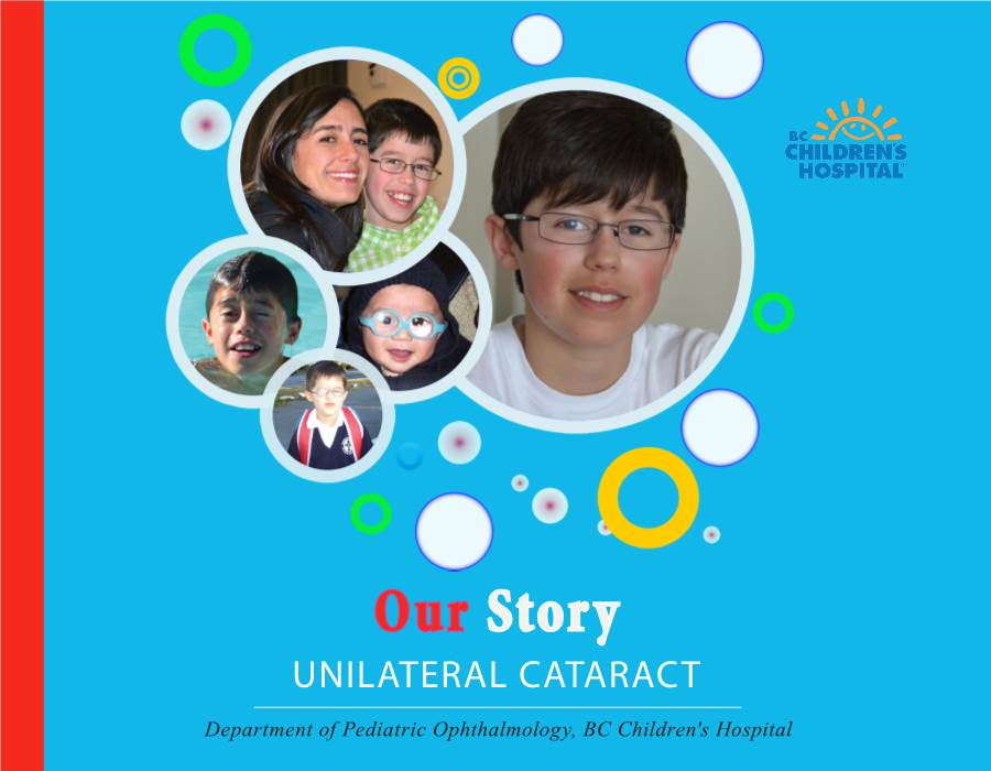 Our Story UNILATERAL CATARACT