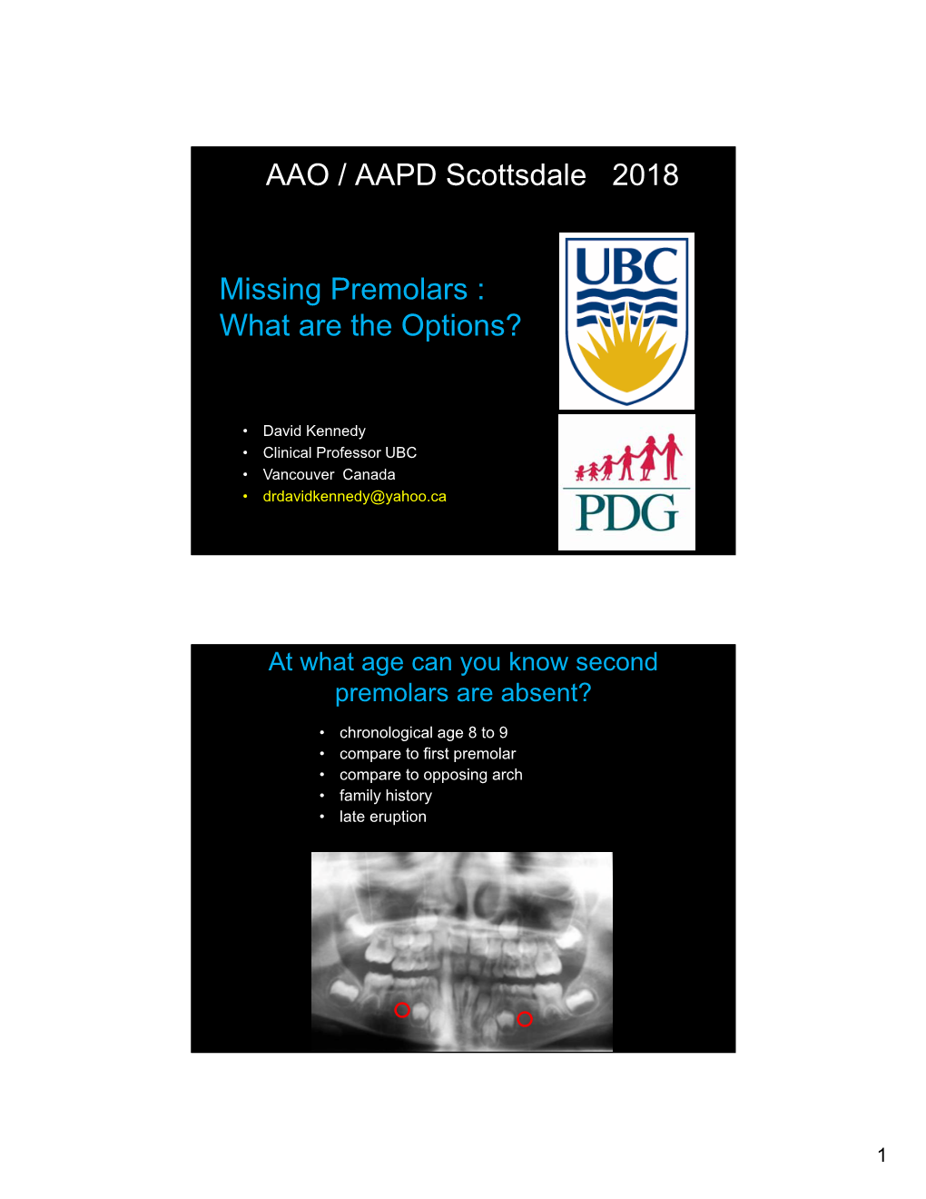 AAO / AAPD Scottsdale 2018 Missing Premolars : What Are the Options?