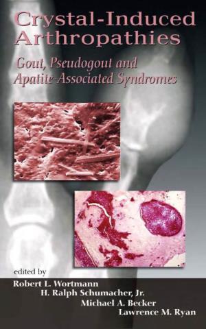 Gout, Pseudogout and Apatite-Associated Syndromes