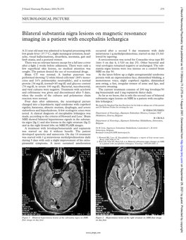 Bilateral Substantia Nigra Lesions on Magnetic Resonance Imaging in a Patient with Encephalitis Lethargica