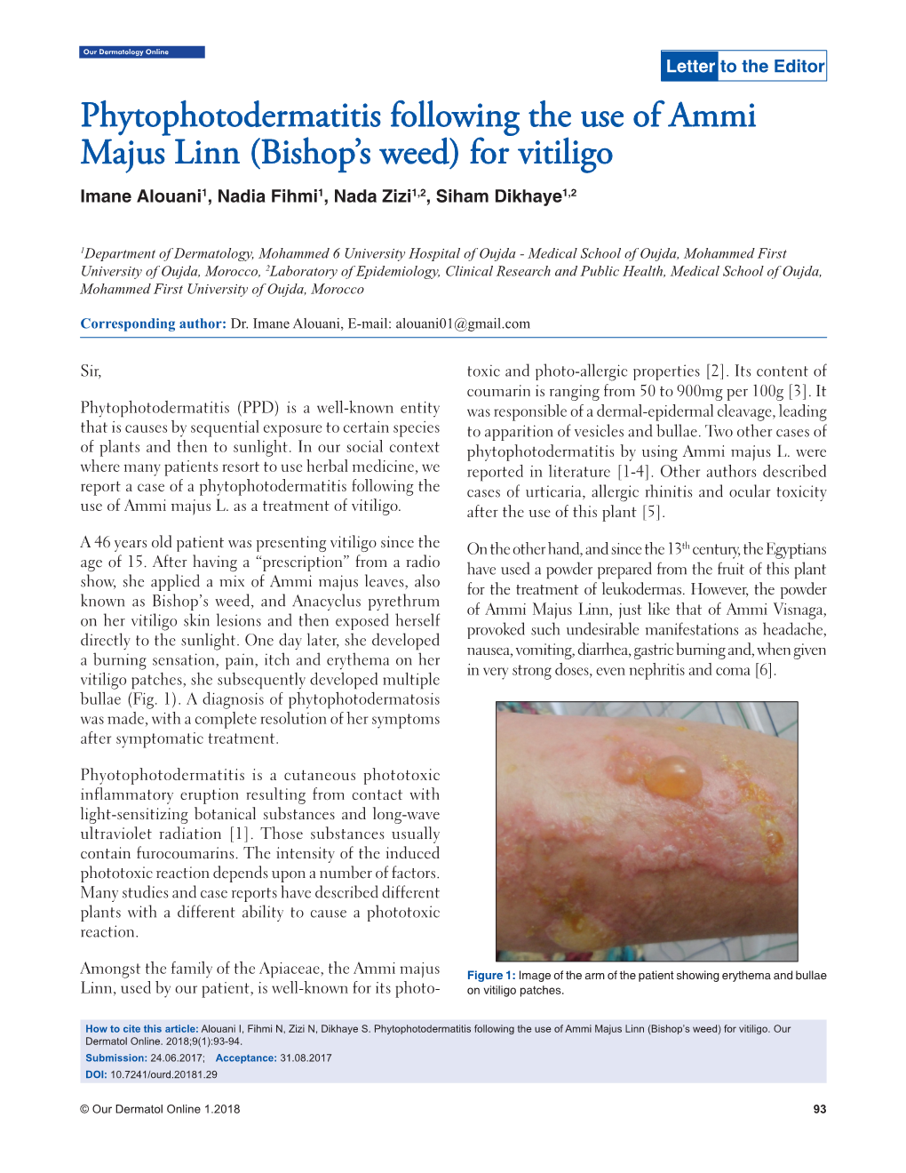 Phytophotodermatitis Following the Use of Ammi Majus Linn (Bishop’S Weed) for Vitiligo