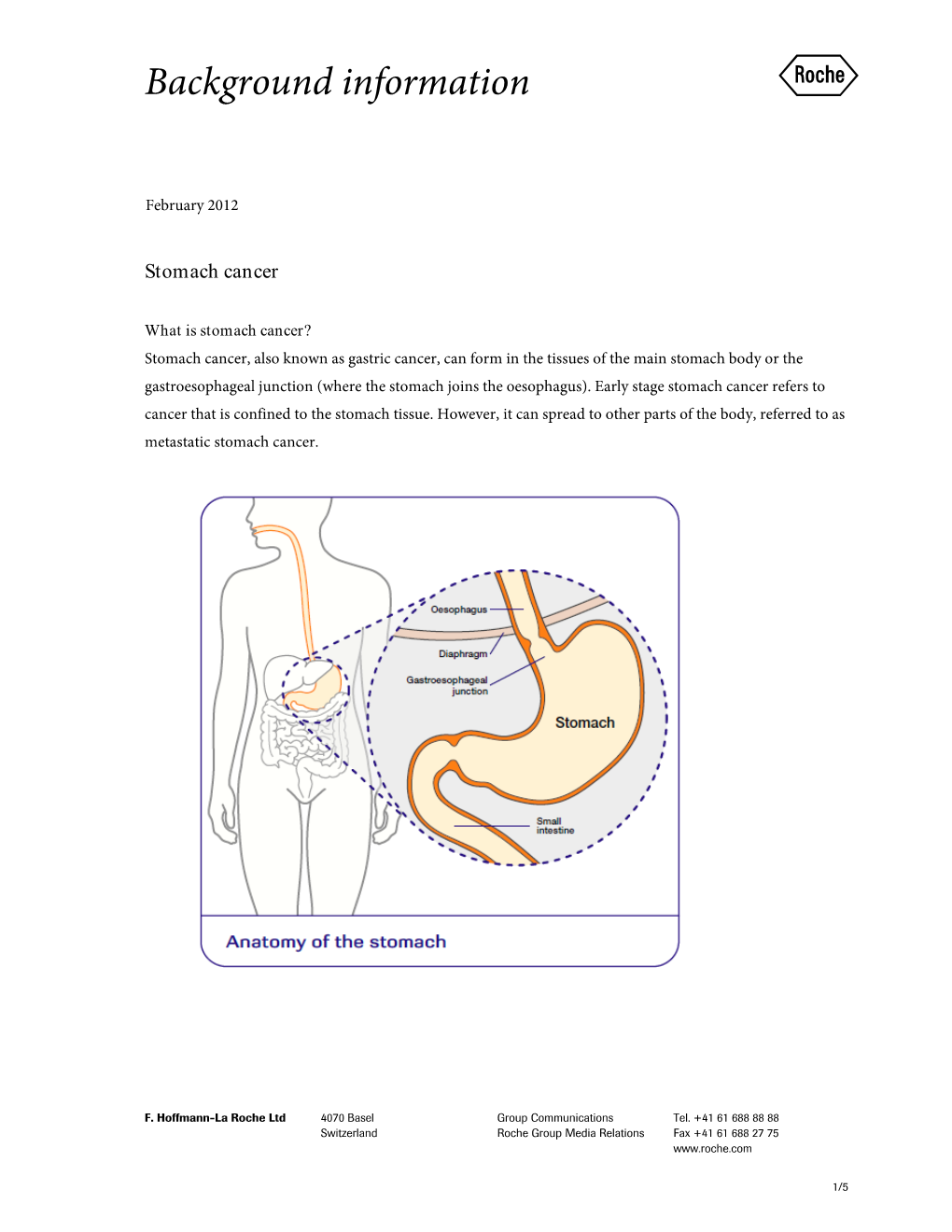 Stomach Cancer