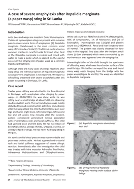 A Case of Severe Anaphylaxis After Ropalidia Marginata (A Paper Wasp