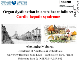 Cardiohepatic Syndrome