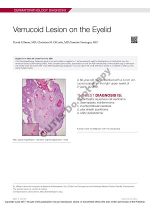 Verrucoid Lesion on the Eyelid