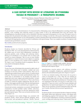 A Case Report with Review of Literature on Pyoderma