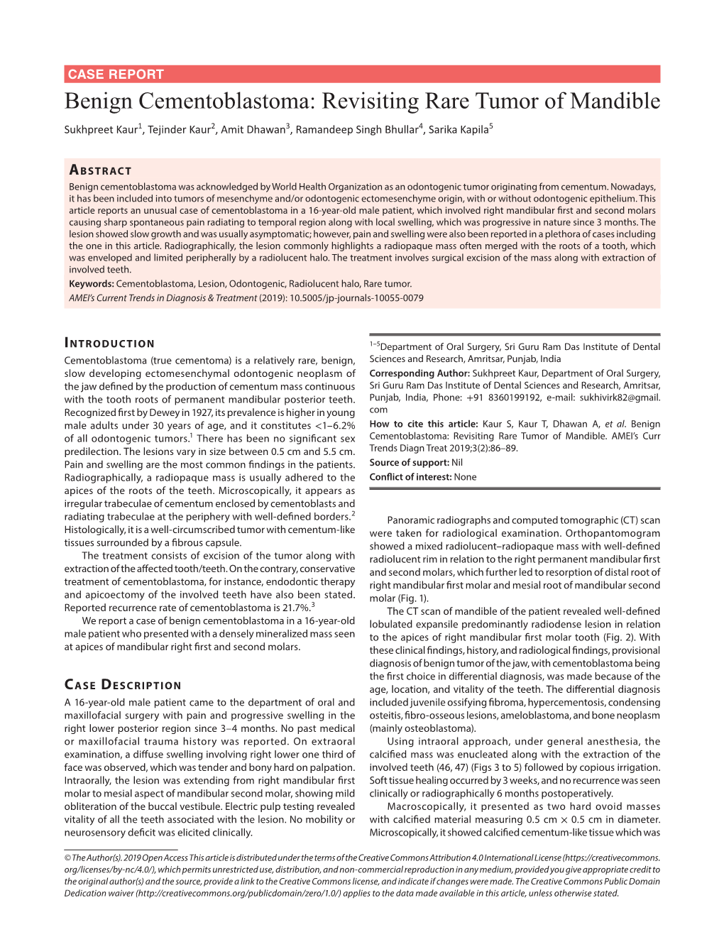 Benign Cementoblastoma: Revisiting Rare Tumor of Mandible Sukhpreet Kaur1, Tejinder Kaur2, Amit Dhawan3, Ramandeep Singh Bhullar4, Sarika Kapila5