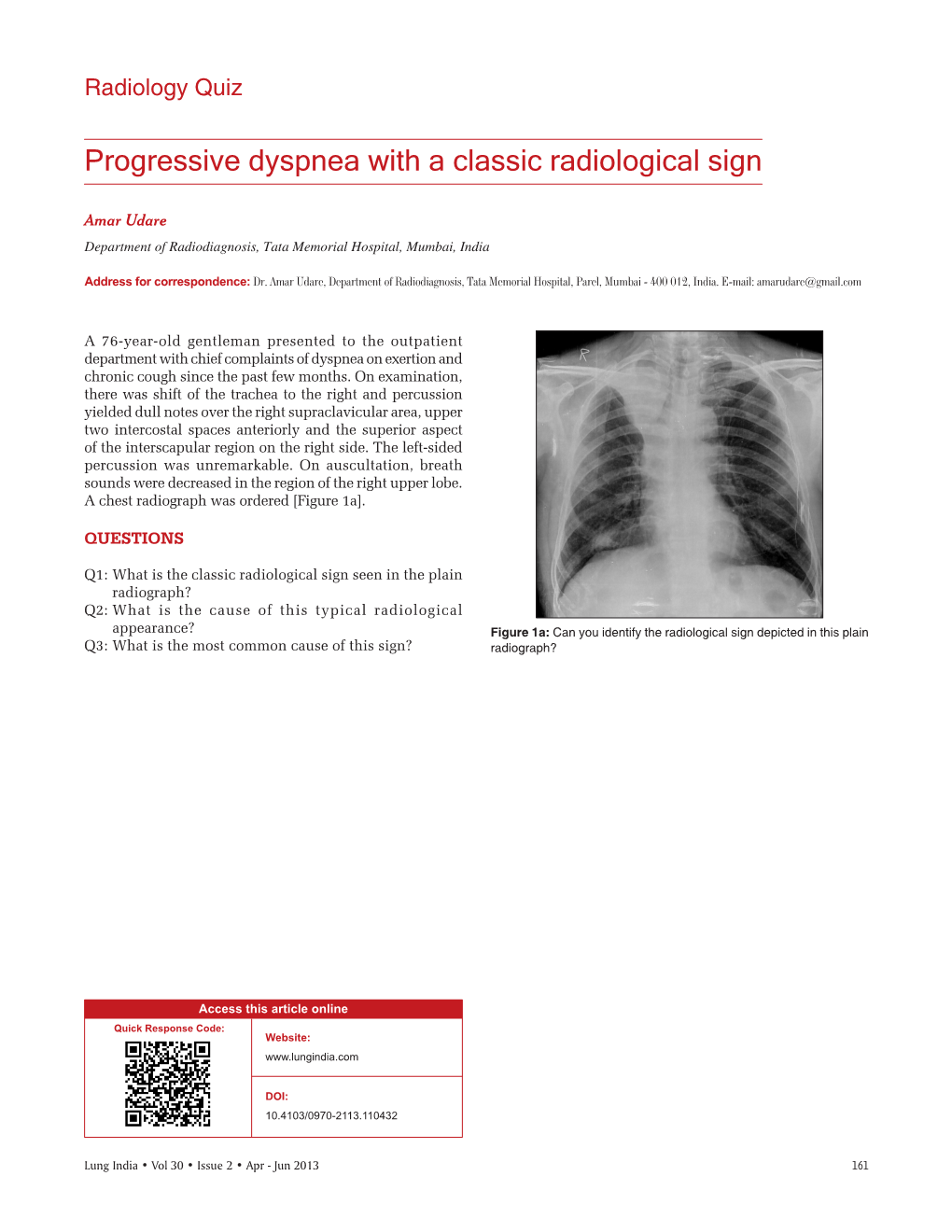 Progressive Dyspnea with a Classic Radiological Sign