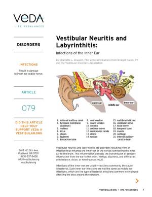 Vestibular Neuritis and Labyrinthitis