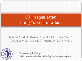 CT Images After Lung Transplantation