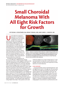 Small Choroidal Melanoma with All Eight Risk Factors for Growth