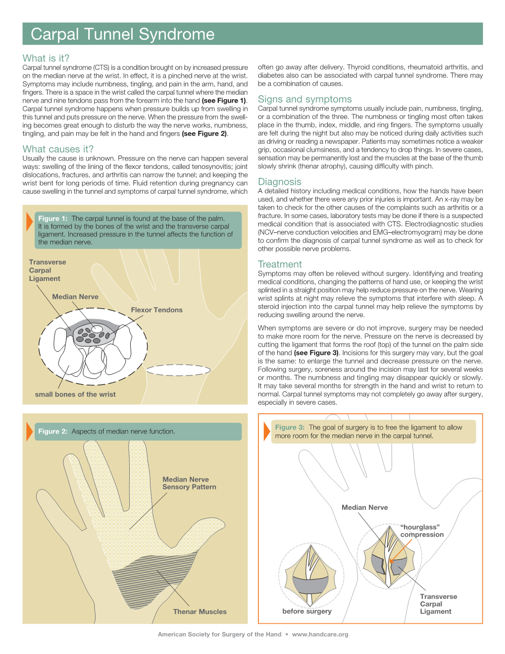 Carpal Tunnel Syndrome