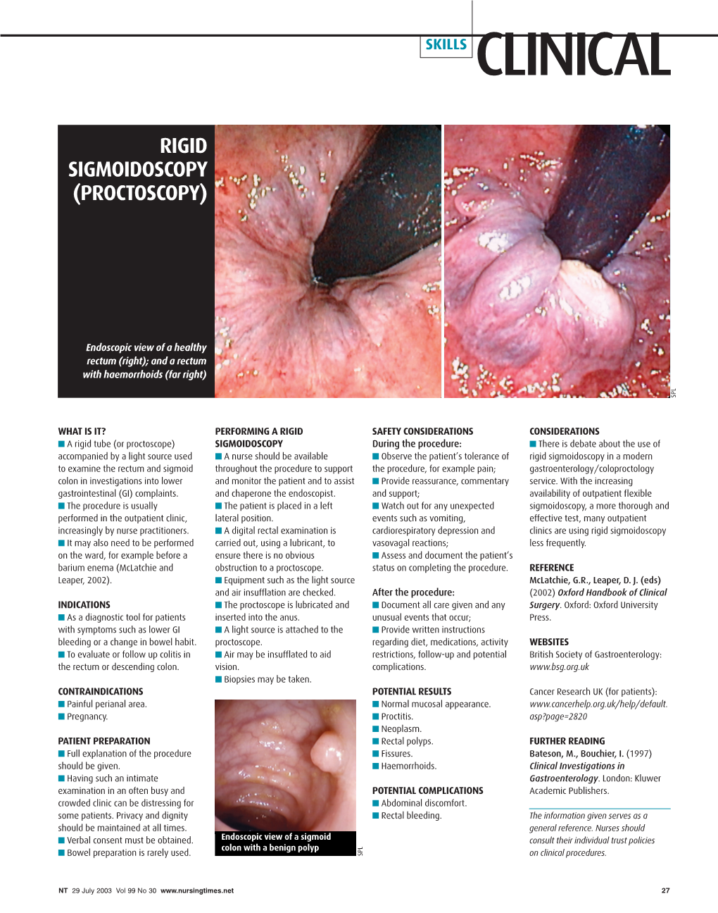 Rigid Sigmoidoscopy (Proctoscopy)