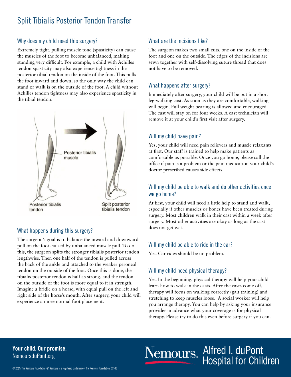 Split Tibialis Posterior Tendon Transfer