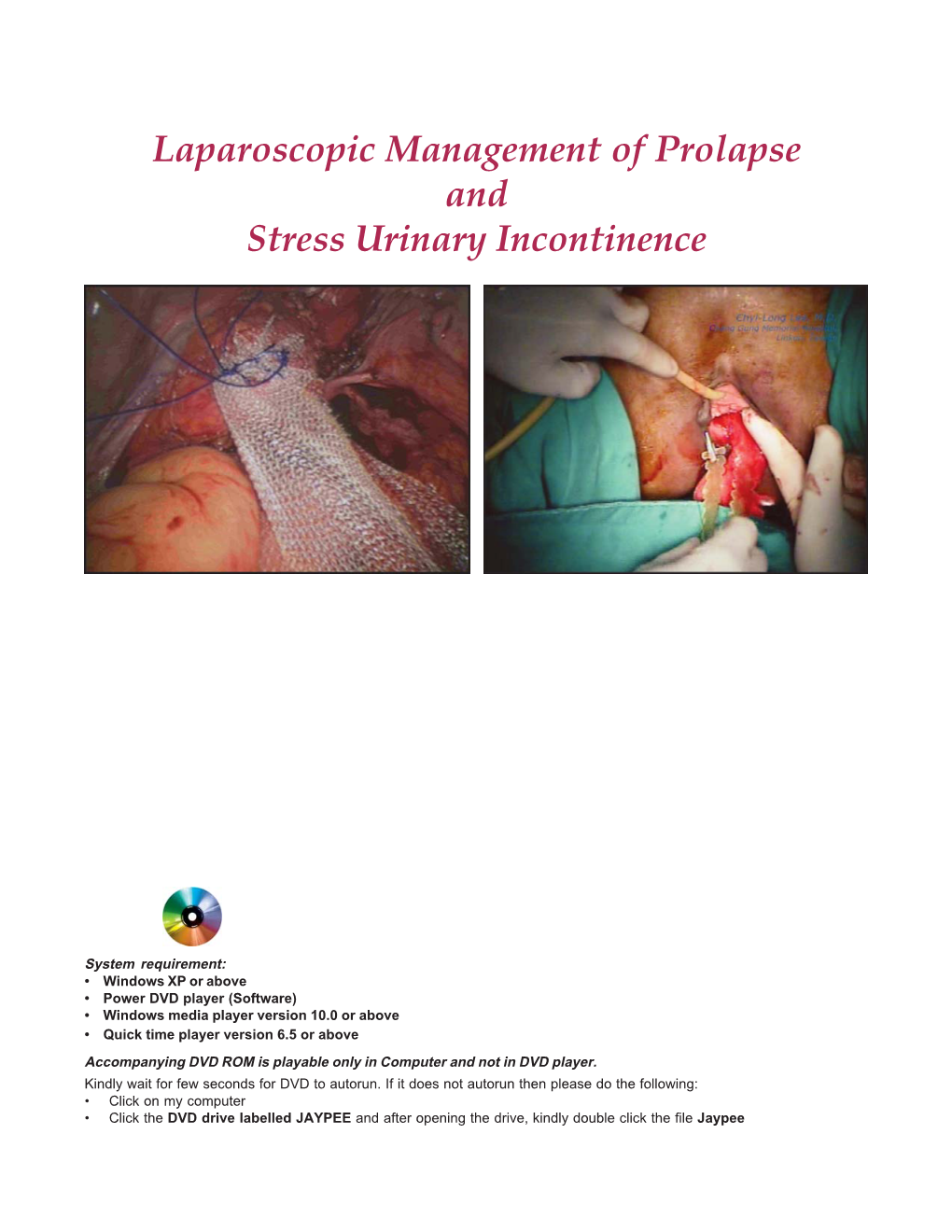 Laparoscopic Management of Prolapse and Stress Urinary Incontinence