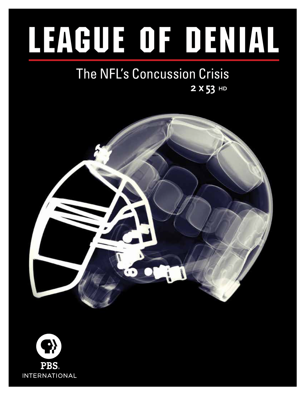 The NFL's Concussion Crisis