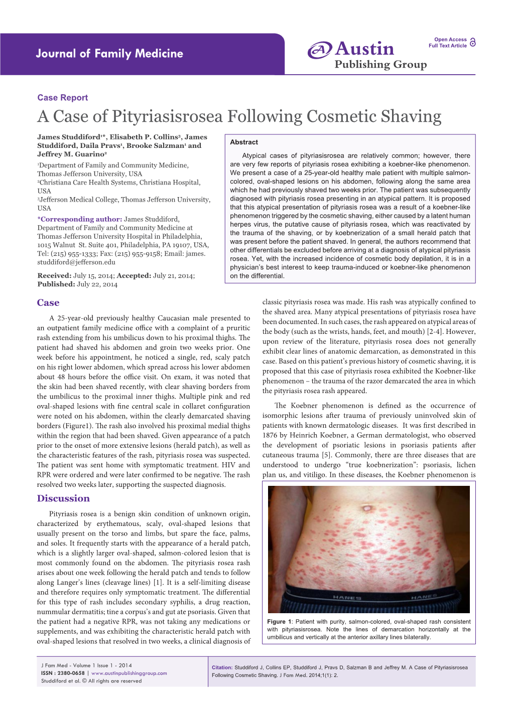 A Case of Pityriasisrosea Following Cosmetic Shaving