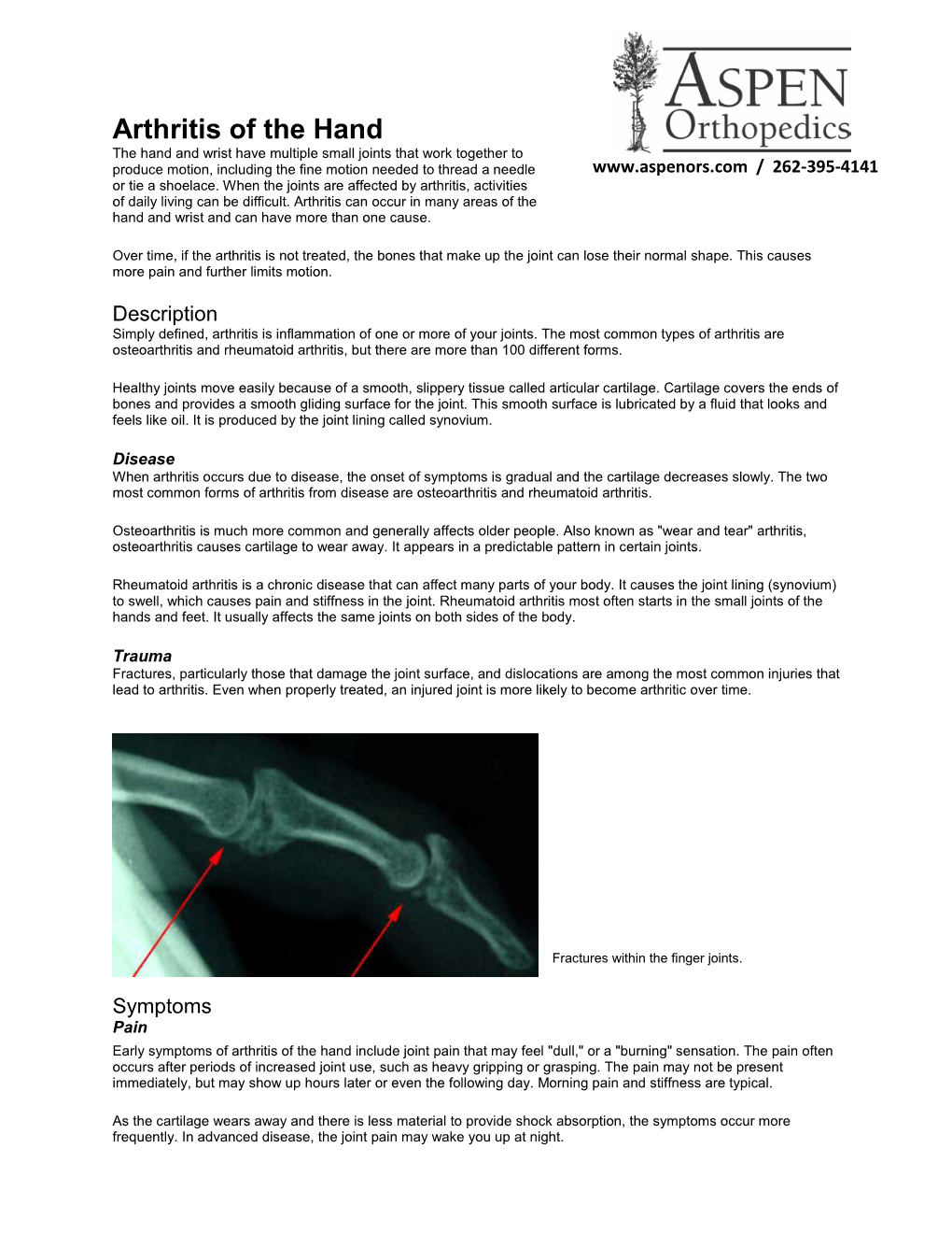 Arthritis of the Hand