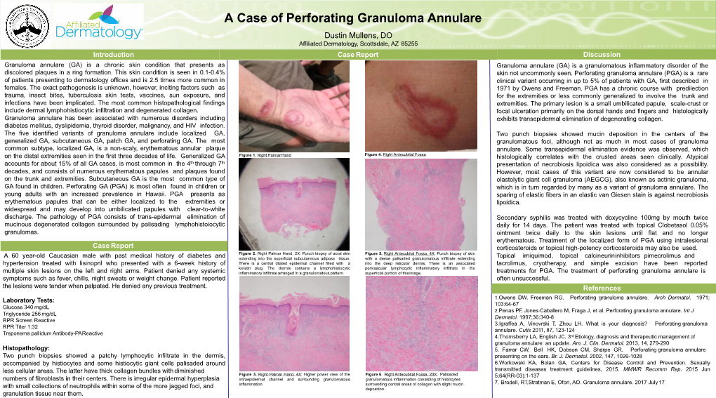 A Case Of Perforating Granuloma Annulare Docslib