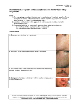 Illustrations of Acceptable and Unacceptable Facial Hair for Tight-Fitting Respirators