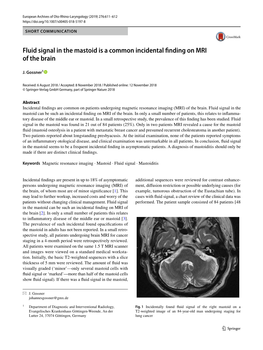 Fluid Signal in the Mastoid Is a Common Incidental Finding on MRI of the Brain