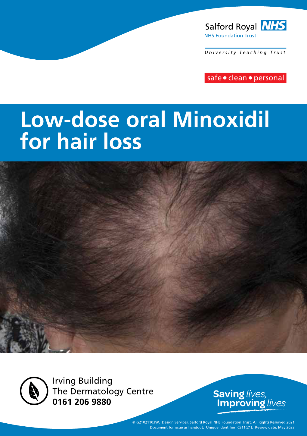 Low-Dose Oral Minoxidil for Hair Loss