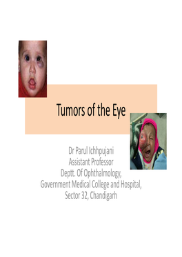 Tumors of the Eye.Pdf