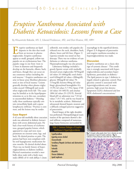 Eruptive Xanthoma Associated with Diabetic Ketoacidosis: Lessons from a Case