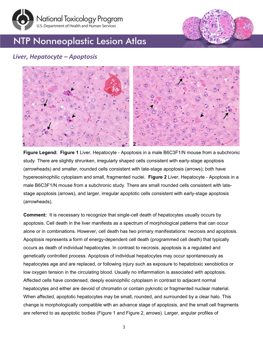 Liver, Hepatocyte – Apoptosis