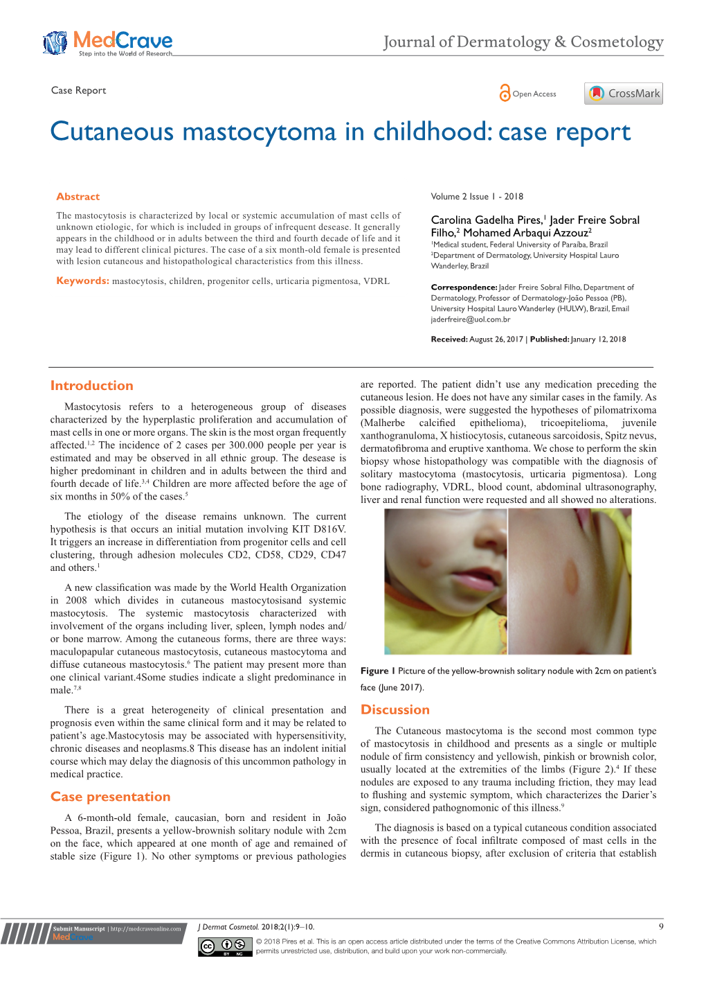 Cutaneous Mastocytoma in Childhood: Case Report