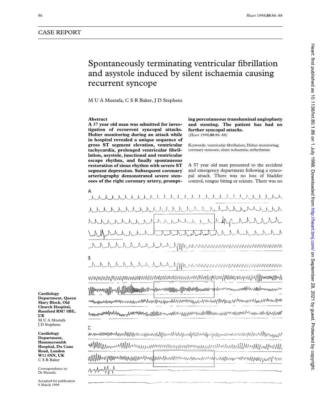 Spontaneously Terminating Ventricular Fibrillation and Asystole Induced By