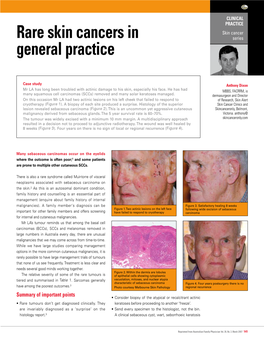 Rare Skin Cancers in General Practice