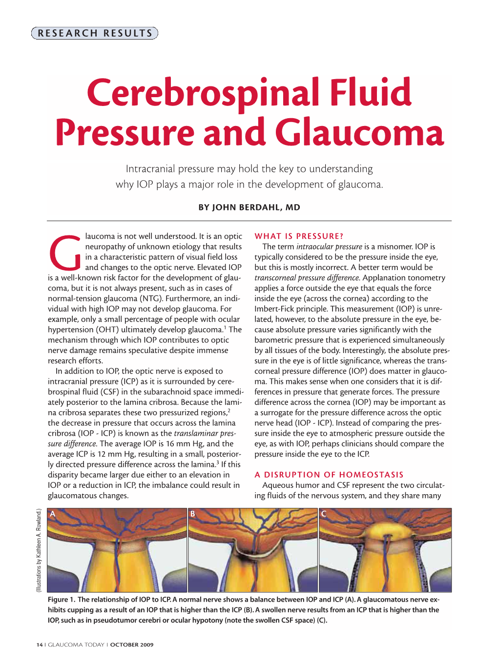 Cerebrospinal Fluid Pressure and Glaucoma Intracranial Pressure May Hold the Key to Understanding Why IOP Plays a Major Role in the Development of Glaucoma